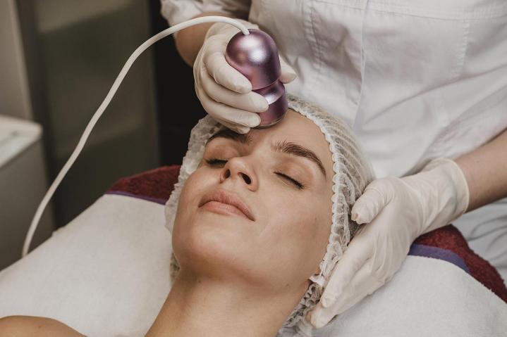 Microneedling par radiofréquence fractionnée Colmar