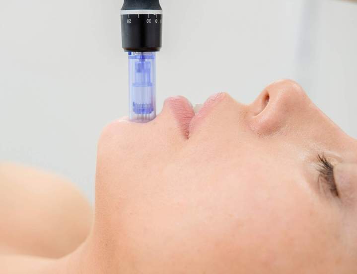 Faire des injections d’acide hyaluronique Colmar