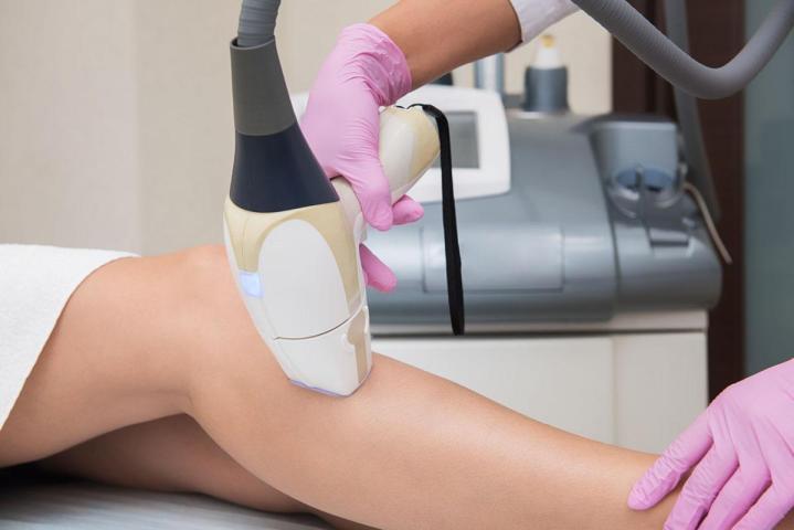 Épilation laser permanent Colmar